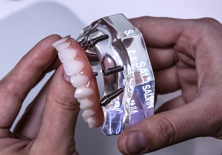 implants
